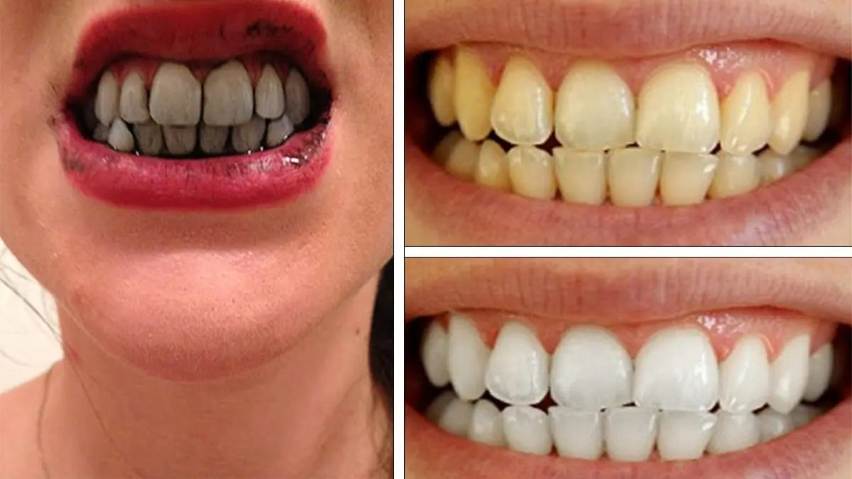 Blanqueador Dental de Carbón Activado — Frasco 50g